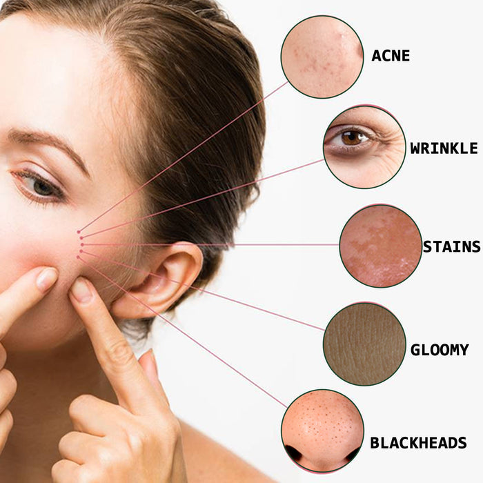 Peau éclatante avec des marques d'acné et points noirs, hydratée et lumineuse, mise en valeur sur une peau naturelle.