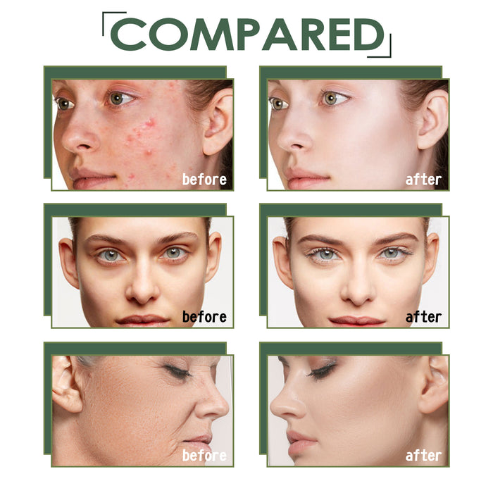 Peau lumineuse avec des taches d'acné et points noirs, produit de soin pour éclaircir la peau.