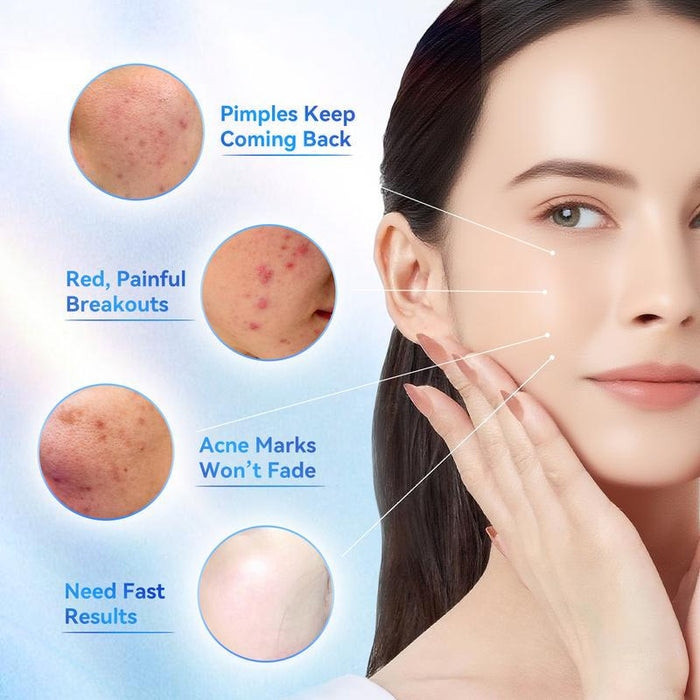 Gel nettoyant et hydratant pour peau acnéique, soins visage doux, produit de la marque.