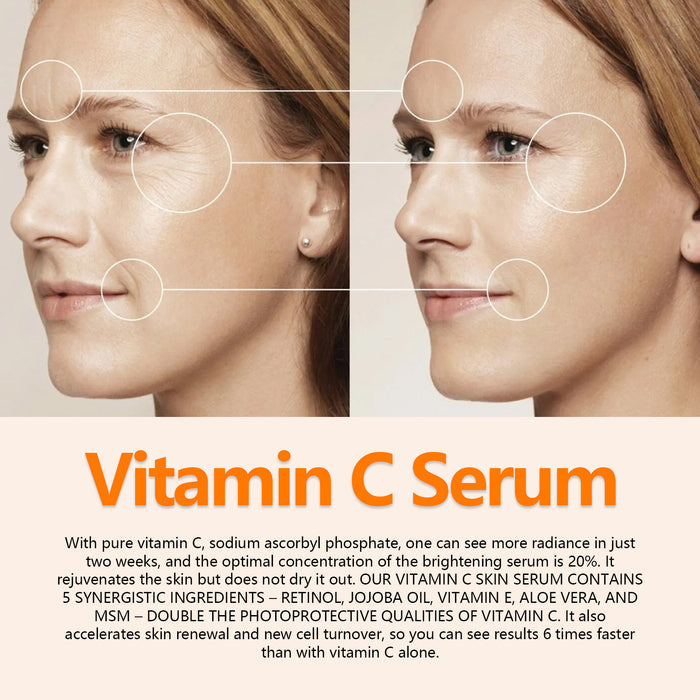 Sérum anti-âge French Lines pour raffermir la peau du visage, réduit les rides et ridules, soin anti-fondu.