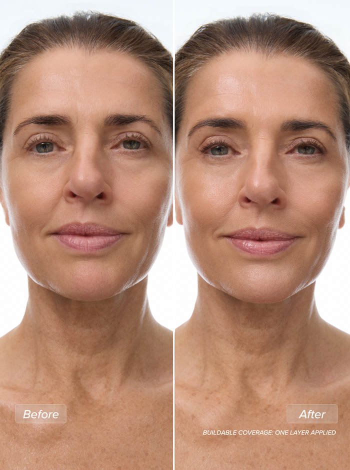 Miracle Skin Tint | Medium