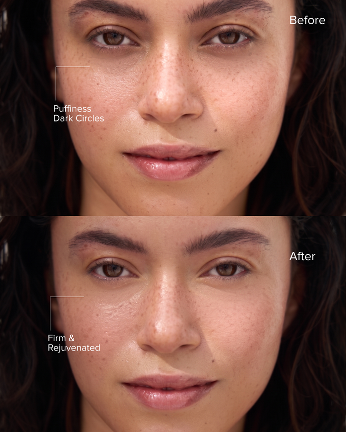 PDRN Multi-Peptide Eye Complex