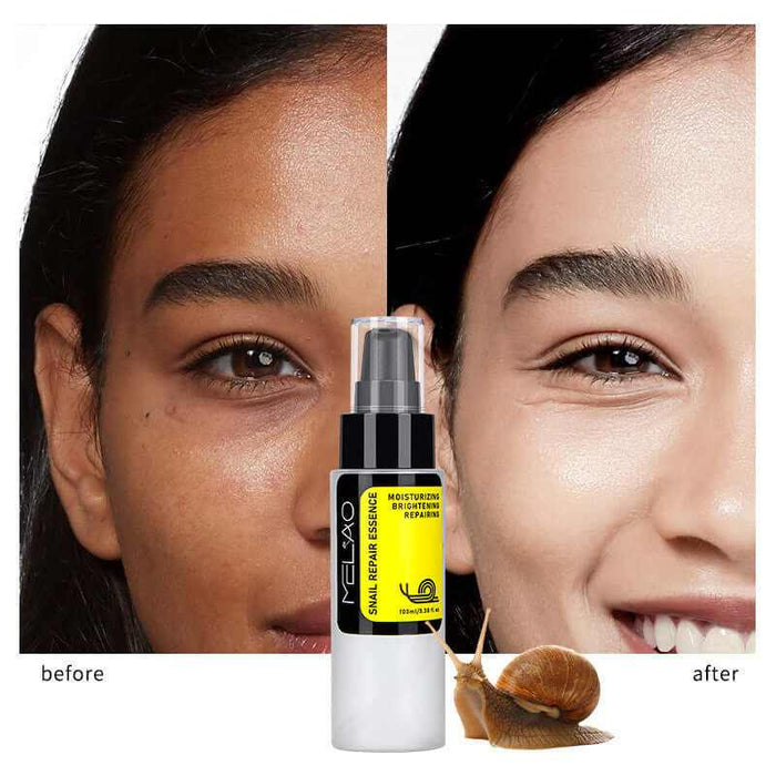 Solution de soin facial à la bave d'escargot pour la peau, flacon blanc avec étiquette, soins du visage naturels.
